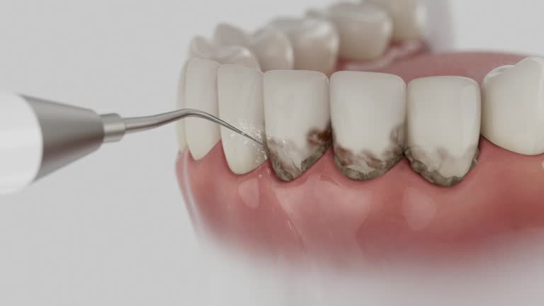 Reliable Dental contractor in Plattsburg, MO by Dentist Open Now